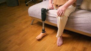 A person with a prosthetic leg sits on a couch, adjusting their artificial limb, representing life after amputation and disability adaptation.