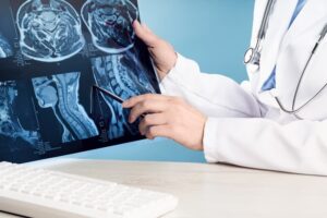 Doctor's hands holding an X-ray or MRI scan displaying a head and neck condition, including the spinal cord, blood vessels, and brain. Neuromedicine.